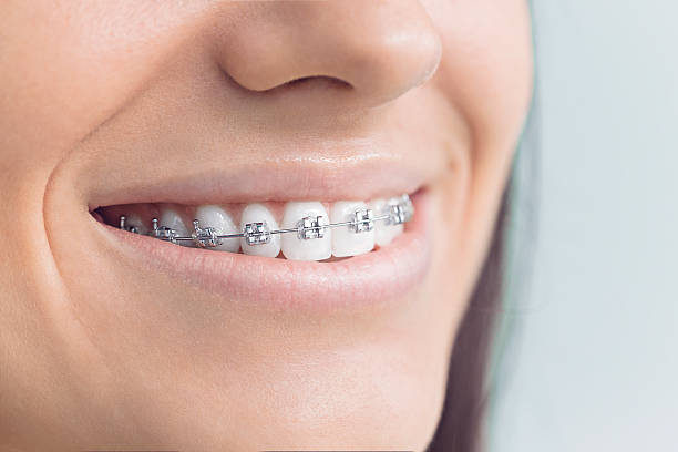 Best Teeth Whitening  in Mathews, LA
